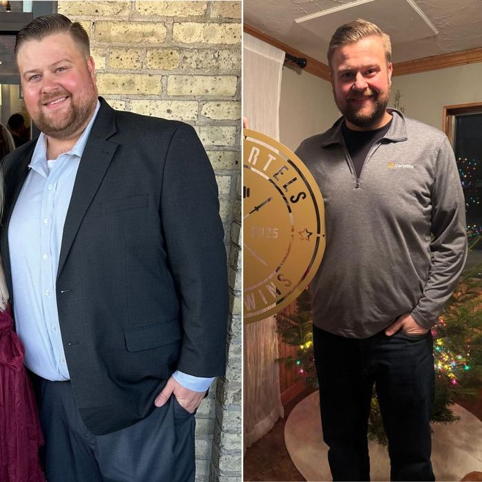 Zach before and after transformation — 130lbs in 12 Months